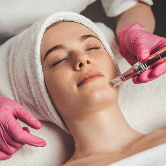 Official cover of the event Dermapen en Madrid