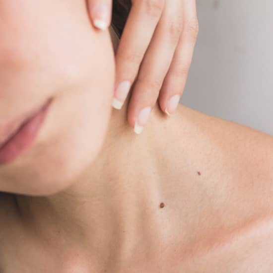 Cartel oficial del evento Tratamiento Peeling